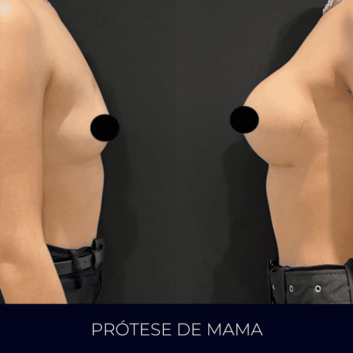 Dr Raul Mendes Martins | Cirurgião Plástico em Curitiba | Lipoaspiração HD Ugraft, Renuvion, Abdominoplastia, Rinoplastia Ultrassônica e Cirurgia Mamária