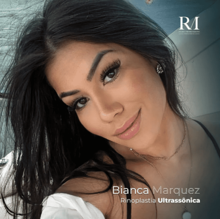 Dr Raul Mendes Martins | Cirurgião Plástico em Curitiba | Lipoaspiração HD Ugraft, Renuvion, Abdominoplastia, Rinoplastia Ultrassônica e Cirurgia Mamária