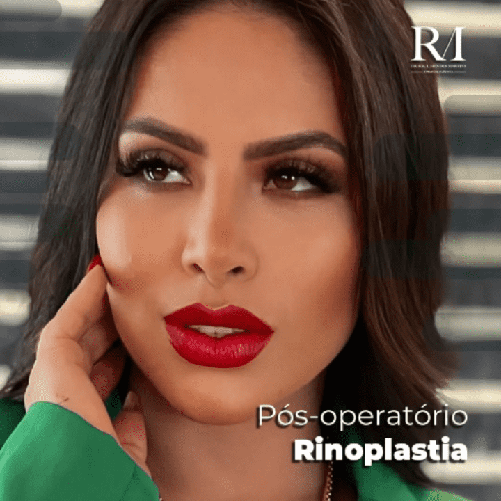 Dr Raul Mendes Martins | Cirurgião Plástico em Curitiba | Lipoaspiração HD Ugraft, Renuvion, Abdominoplastia, Rinoplastia Ultrassônica e Cirurgia Mamária