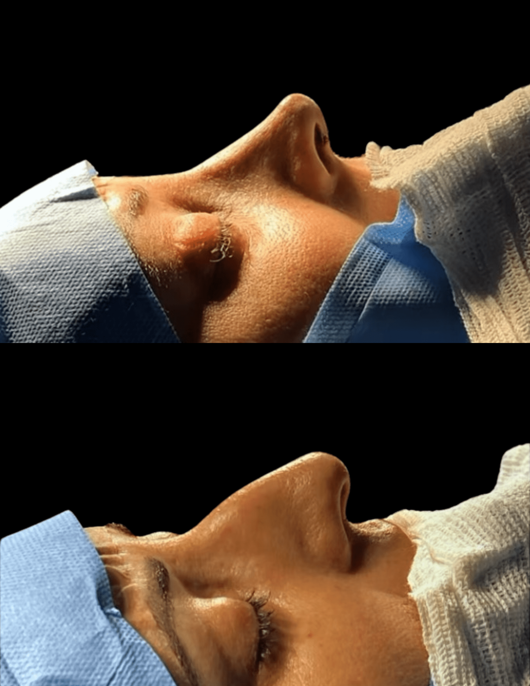Dr Raul Mendes Martins | Cirurgião Plástico em Curitiba | Lipoaspiração HD Ugraft, Renuvion, Abdominoplastia, Rinoplastia Ultrassônica e Cirurgia Mamária