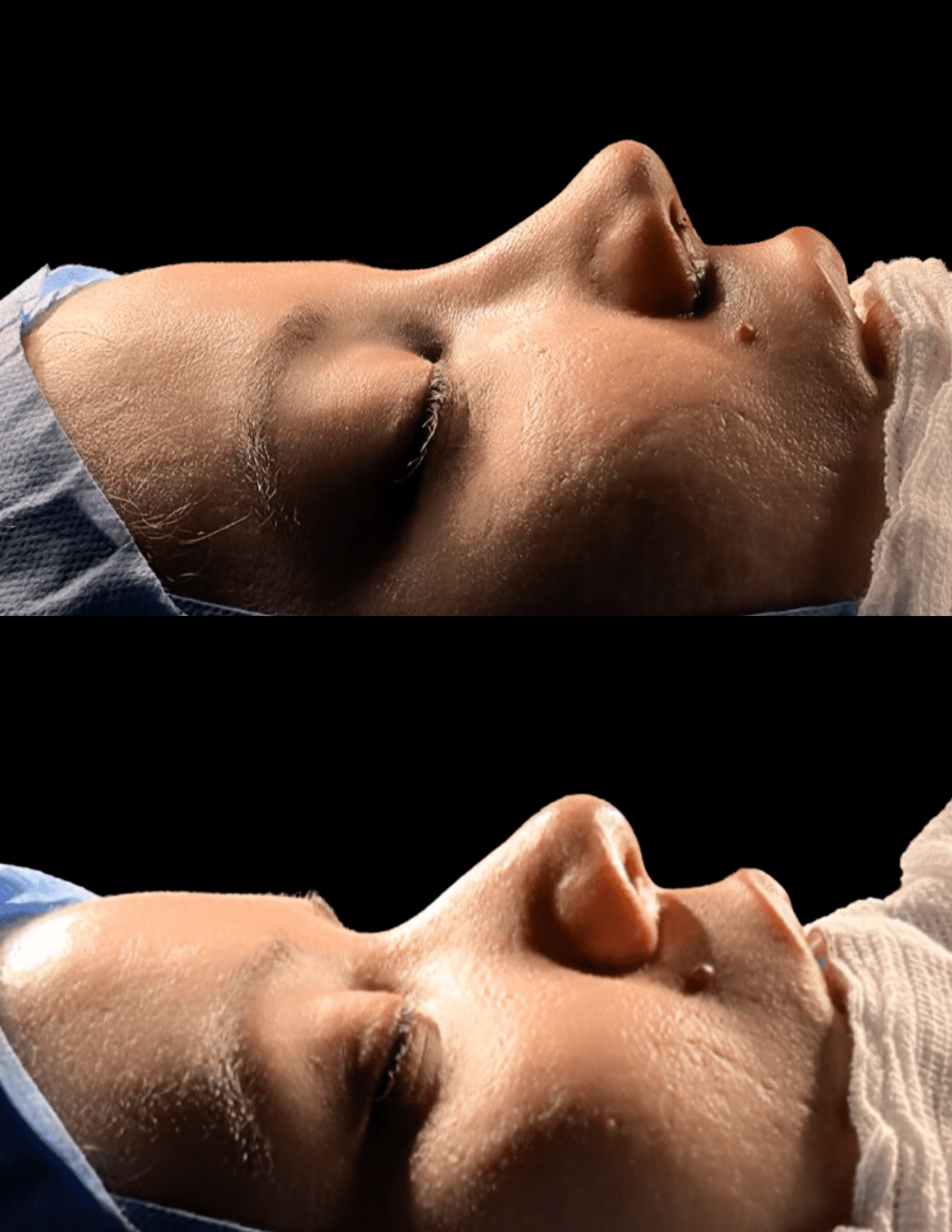 Dr Raul Mendes Martins | Cirurgião Plástico em Curitiba | Lipoaspiração HD Ugraft, Renuvion, Abdominoplastia, Rinoplastia Ultrassônica e Cirurgia Mamária