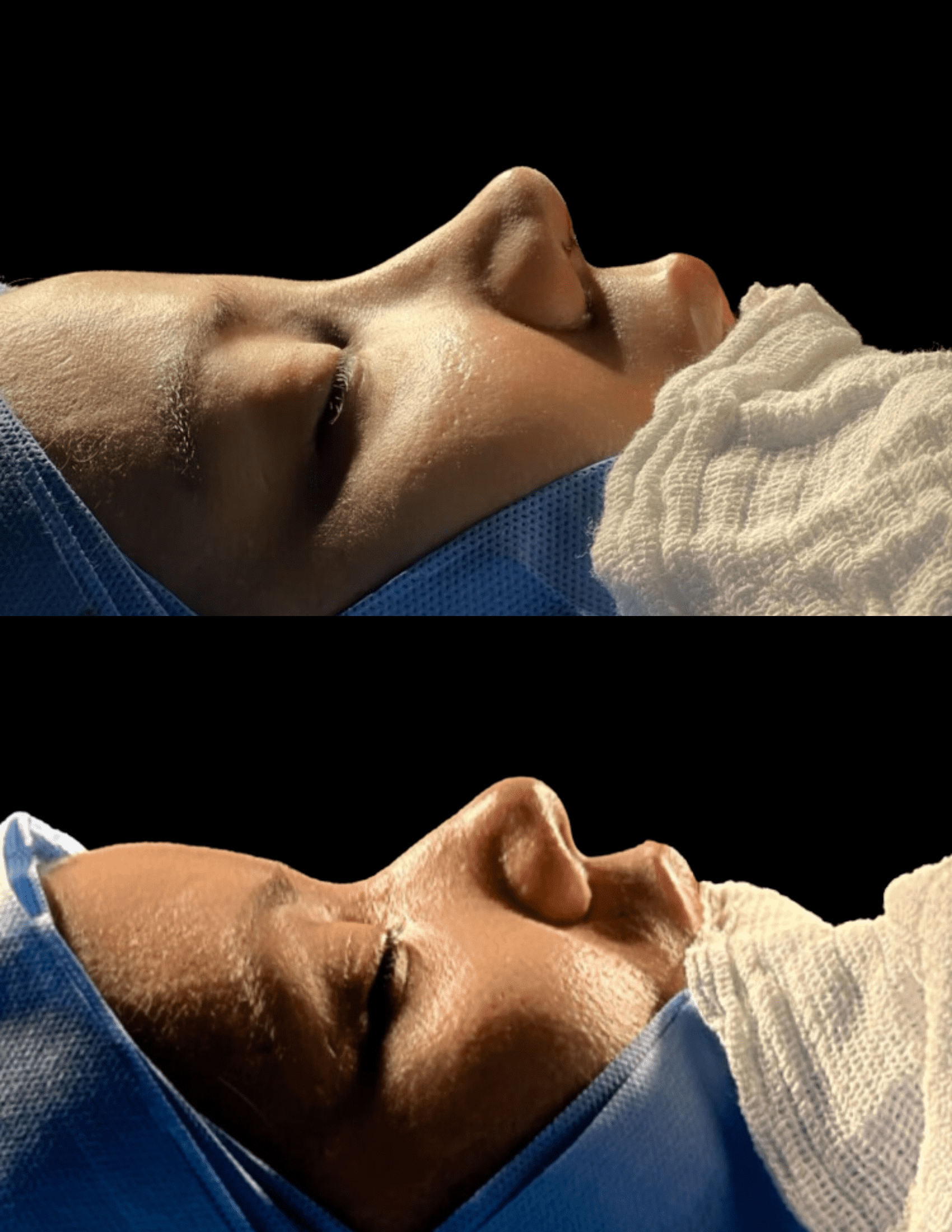 Dr Raul Mendes Martins | Cirurgião Plástico em Curitiba | Lipoaspiração HD Ugraft, Renuvion, Abdominoplastia, Rinoplastia Ultrassônica e Cirurgia Mamária