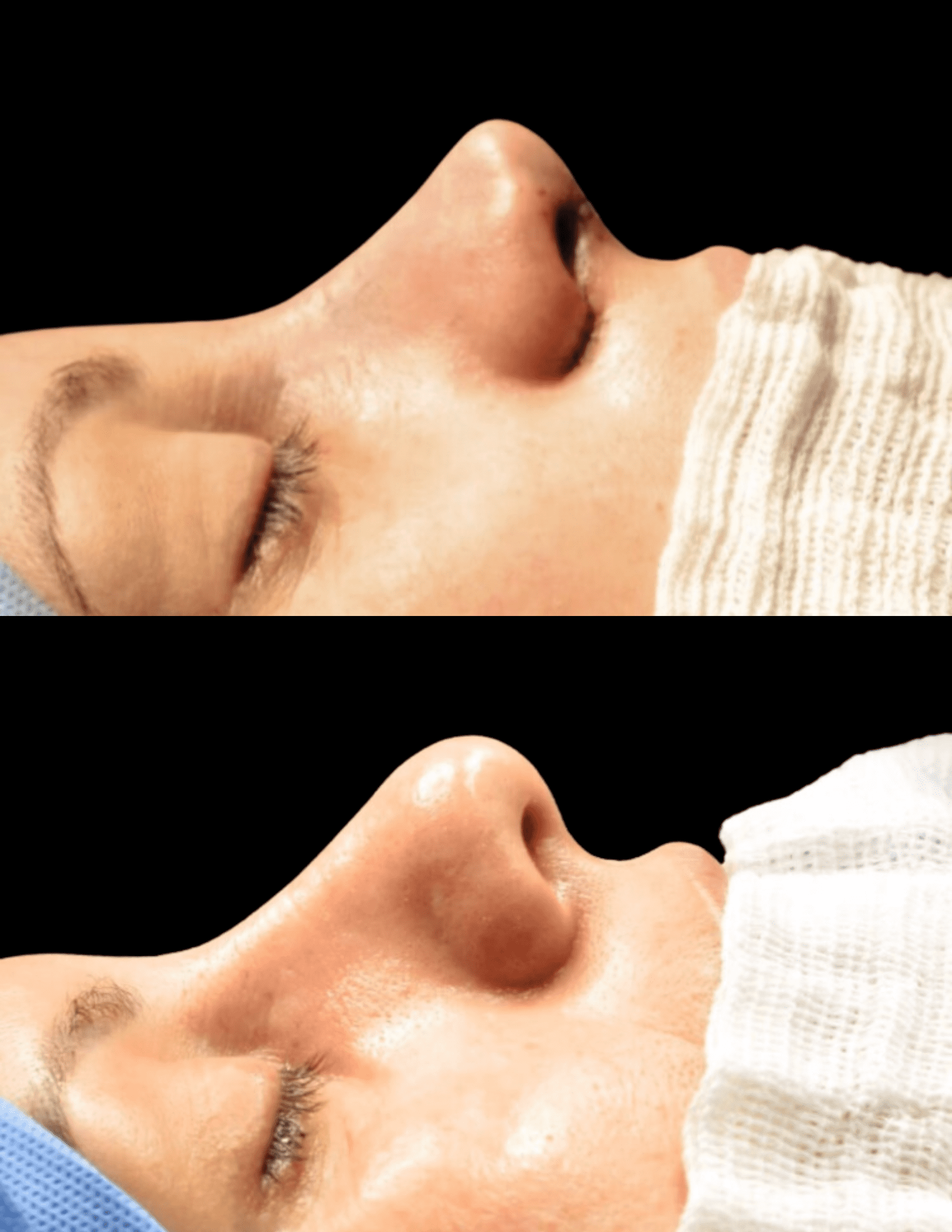 Dr Raul Mendes Martins | Cirurgião Plástico em Curitiba | Lipoaspiração HD Ugraft, Renuvion, Abdominoplastia, Rinoplastia Ultrassônica e Cirurgia Mamária
