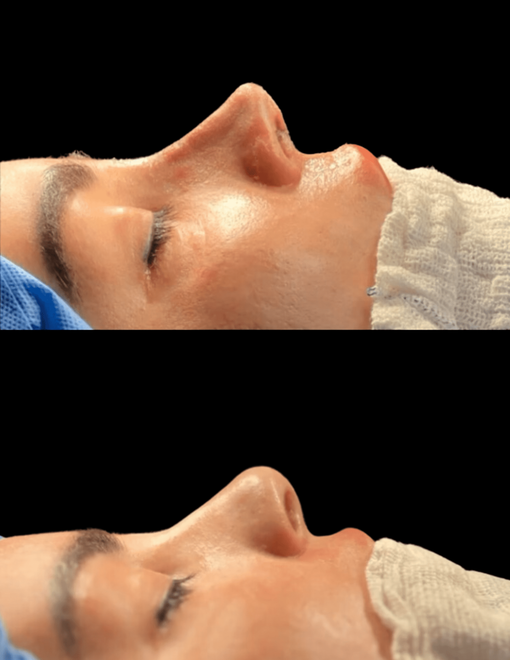 Dr Raul Mendes Martins | Cirurgião Plástico em Curitiba | Lipoaspiração HD Ugraft, Renuvion, Abdominoplastia, Rinoplastia Ultrassônica e Cirurgia Mamária