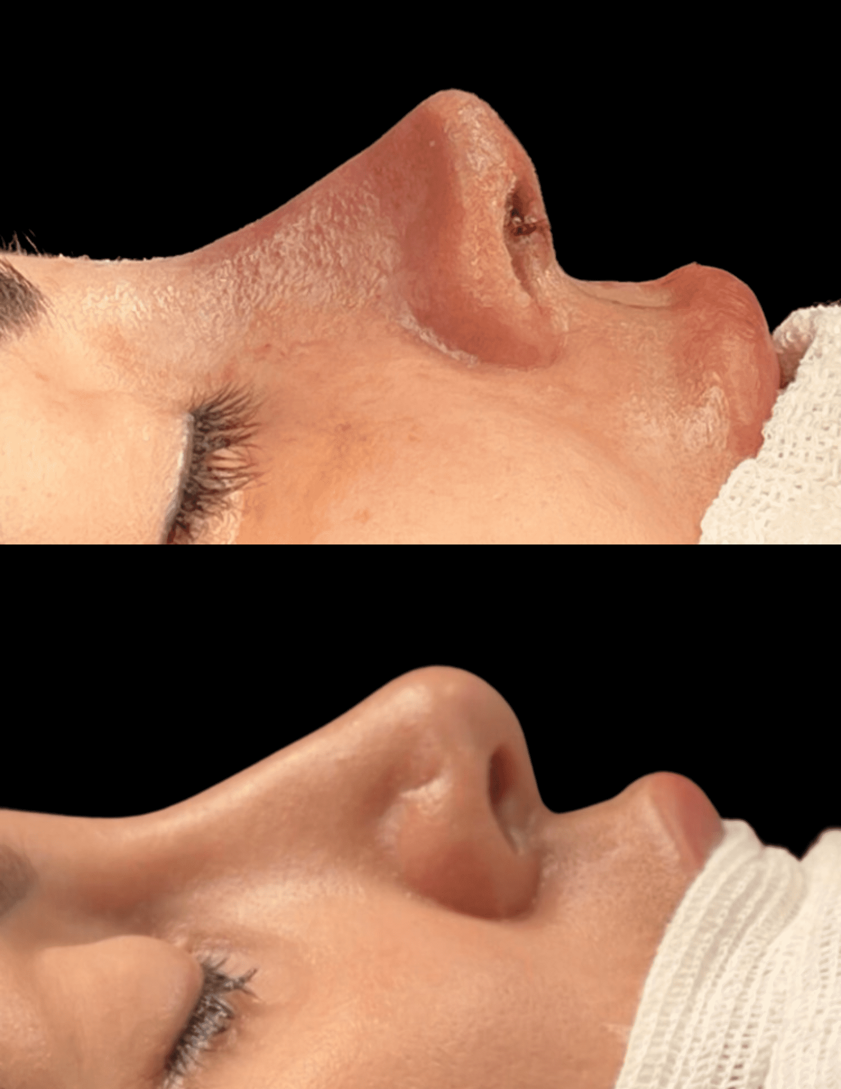 Dr Raul Mendes Martins | Cirurgião Plástico em Curitiba | Lipoaspiração HD Ugraft, Renuvion, Abdominoplastia, Rinoplastia Ultrassônica e Cirurgia Mamária