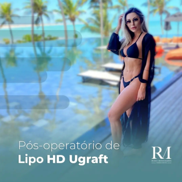 Dr Raul Mendes Martins | Cirurgião Plástico em Curitiba | Lipoaspiração HD Ugraft, Renuvion, Abdominoplastia, Rinoplastia Ultrassônica e Cirurgia Mamária