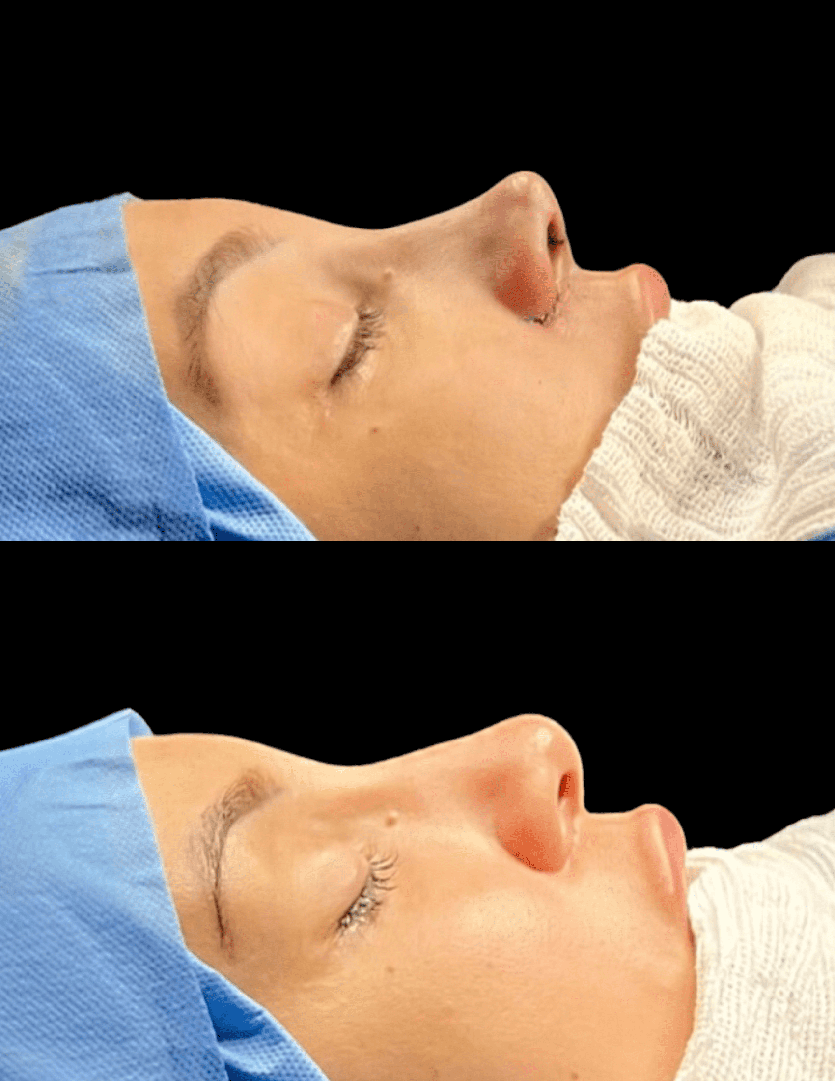 Dr Raul Mendes Martins | Cirurgião Plástico em Curitiba | Lipoaspiração HD Ugraft, Renuvion, Abdominoplastia, Rinoplastia Ultrassônica e Cirurgia Mamária