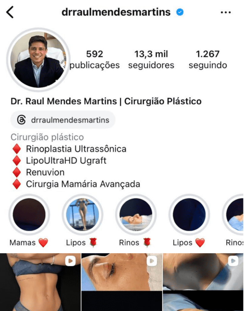 Dr Raul Mendes Martins | Cirurgião Plástico em Curitiba | Lipoaspiração HD Ugraft, Renuvion, Abdominoplastia, Rinoplastia Ultrassônica e Cirurgia Mamária
